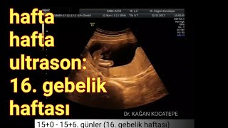 16. gebelik haftasında anne karnındaki erkek bebek - açıklamalı ultrason görüntü