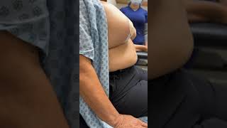 Back To Work & Driving 3 Days After A Breast Lift By Dr Gabriel Patino 06 19 2023.510525-7999