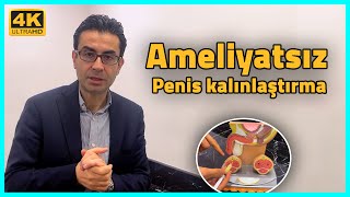 Ameliyatsız yan etkisiz Penis kalınlaştırma yöntemleri - Doç. Dr. Muhsin Balaban