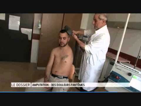 Tpe Amputation Allô Docteur Tpe Amputation Allô Docteur