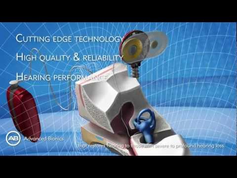 Advanced Bionics HiResolution Bionic Ear system: HiRes90K cochlear implant Neptune Harmony SoundWave