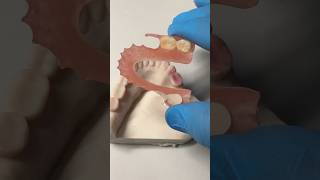 Fiberflex Partial For Dr. Ryan Coursey In Oklahoma