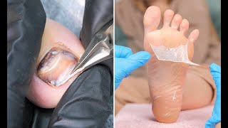 How Podologist Brings Feet To Perfect Condition