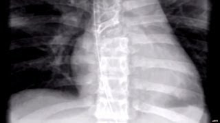 Paralyzed, A Racing Driver Beats The Odds - JALOPNIK ON /DRIVE