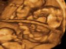 4d baby scan of quads playing
