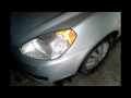 2009 Hyundai Accent Front and Rear mud flap install plus more