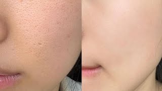 Experimental Textureless Baby Skin ୨୧ Deep Exfoliation 1X
