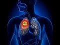 Fé­lel­me­tes tü­dő­be­teg­ség terjed hazánkban