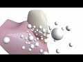remineralizes