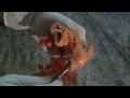 Postmortem Dissection of Heart-Part-I