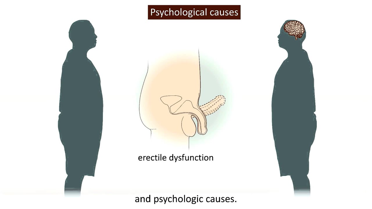 Can masturbation cause erectile disfunction