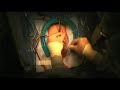 Surgical Treatment for Female Stress Urinary Incontinence