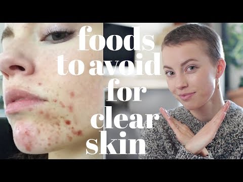 Foods To AVOID For Clear Skin - YouTube