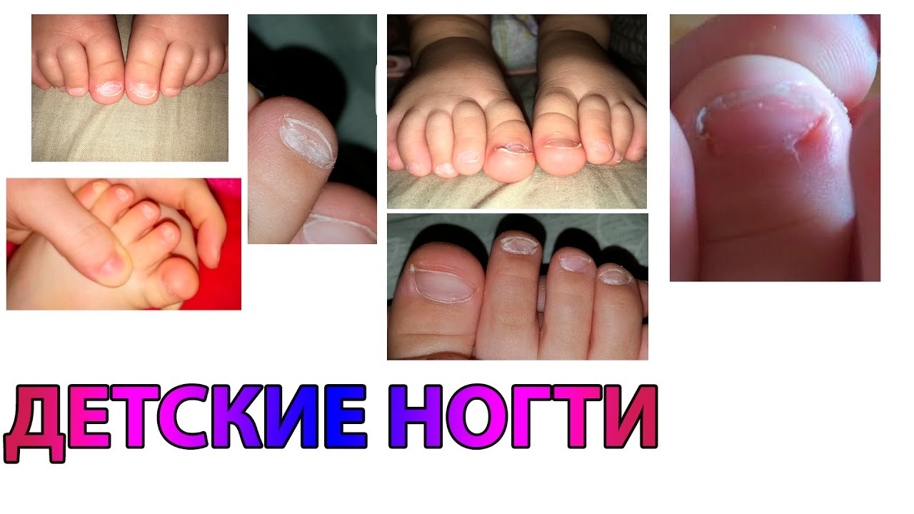Кто лечит травмы ногтей Кто лечит травмы ногтей
