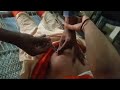 Bhabhi ji ko lagaya injection 💉 Funny injection vlogs video Intramscular injection video