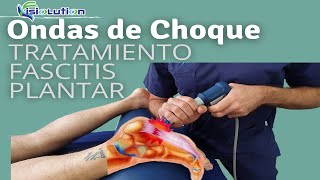 Ondas+de+Choque%3a+espol%c3%b3n+calc%c3%a1neo+(tratamiento+y+testimonio).