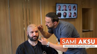 Attore Sami Aksu I Processo Di Trapianto Di Capelli I Murat Makascı Clinic