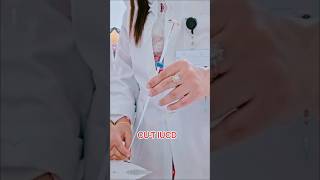 Cu -T Iucd Insertion