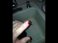 Pointer finger tip cut off and cauterized