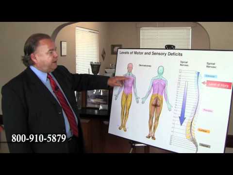 Paralyzed From Chest Down - NC Accident Attorney Brent Adams Explains