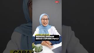 Hilangkan Bekas Cupang Dengan Cepat