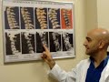 diagnostiquer l'arthrose cervicale