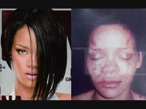 rihanna bruises from chris brown. Rihanna#39;s bruised face