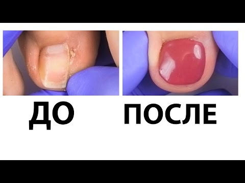 Катя Янг о молодости и долголетии Блог о стиле Лавинии Лонд Как дезинфицировать инструменты для маникюра