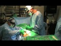ROX Hernia Center Removal of Infected Groin Mesh & Flap Reconstruction
