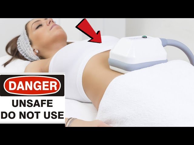 Dangerous side effect of Fat Freezing Cool Sculpting PAH?