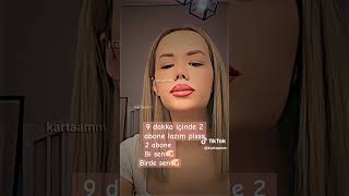 Lan 2 Abone Lazım Be