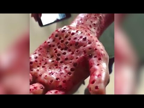 Under The Ribs Of Death Video