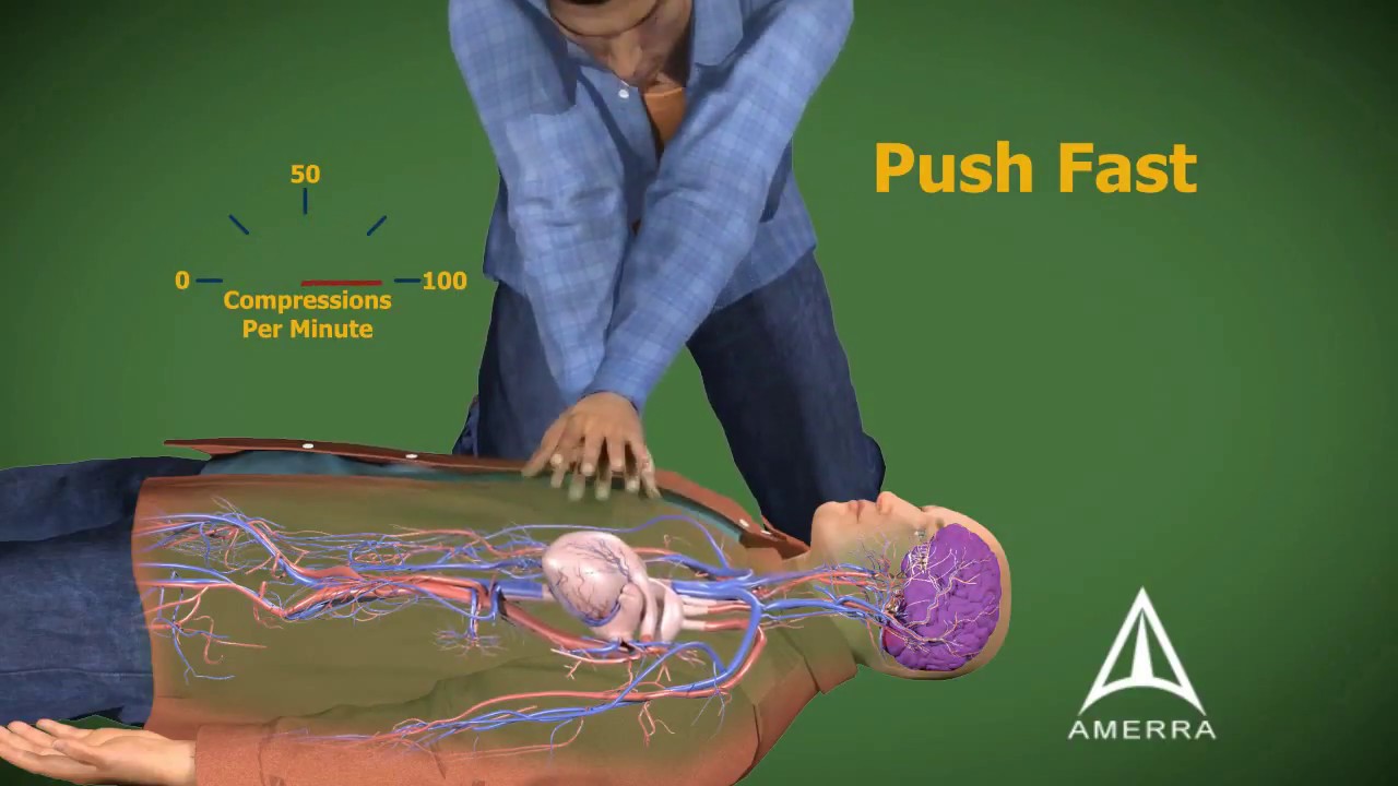Cardiopulmonary Resuscitation - CPR - 3D Medical Animation - YouTube
