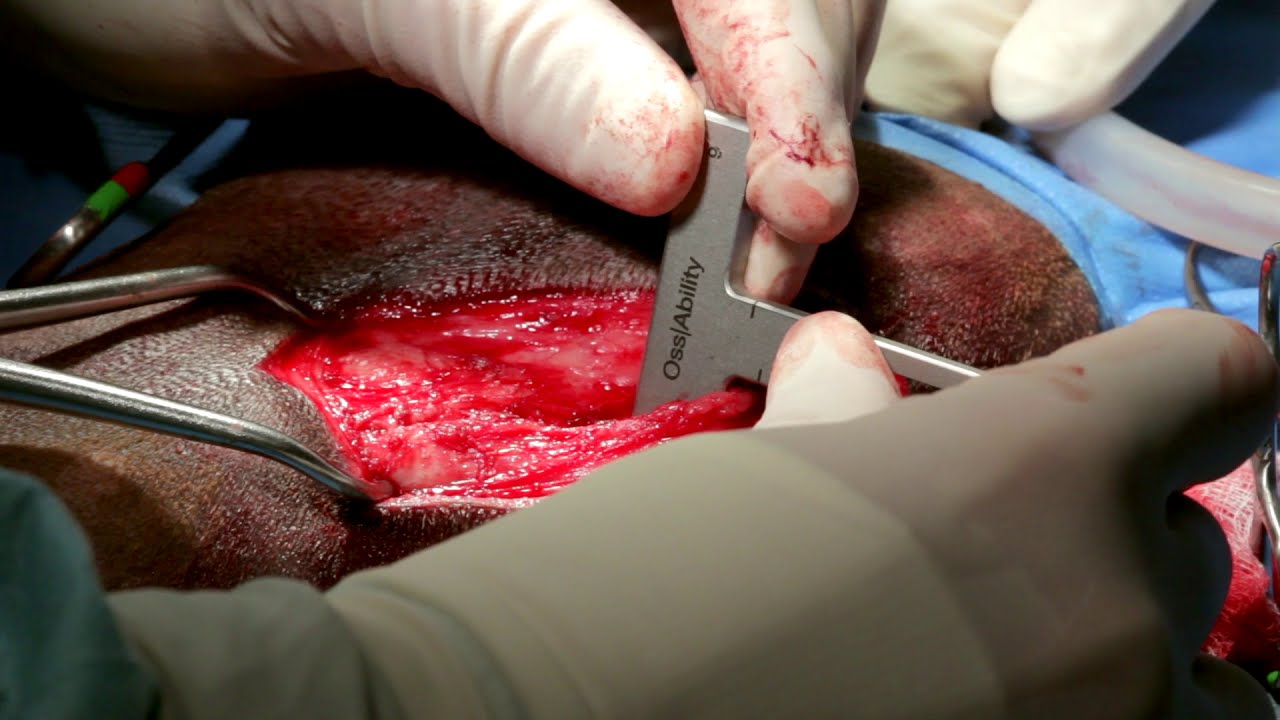 Surgical Videos