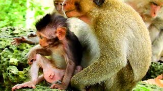 Oh My God Help Me Fire Ant Bite On My Special ,Baby Scratch So Much, If Bite You Will Know