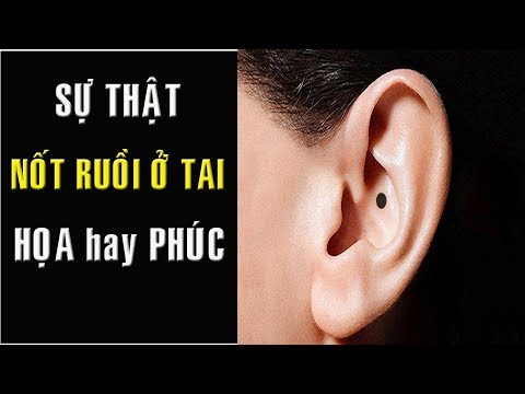 Sự thật nốt ruồi ở TAI là HỌA HAY PHÚC phong thủy nốt ruồi cực chuẩn