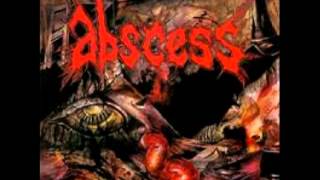 Watch Abscess Death Runs Red video