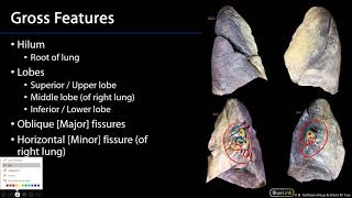 Lungs And Ventilation Pathway - Surfaces And Gross Features Of Lungs