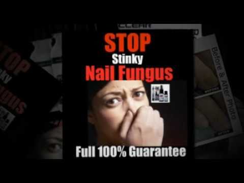 published: 29 Oct 2010. author: NailTreatment101. Cure Nail Fungus