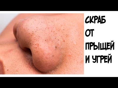 Как быстро избавиться от прыщей в домашних условиях за 1 Как быстро избавиться от прыщей в домашних условиях за 1
