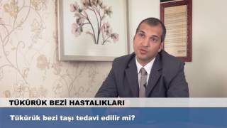 Tükürük Bezi Taşı Tedavi Edilir Mi?