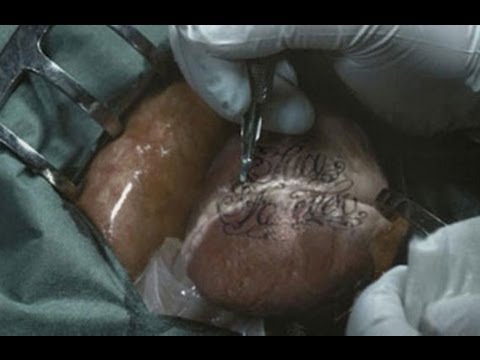 Si es nocivo el aumento del pene