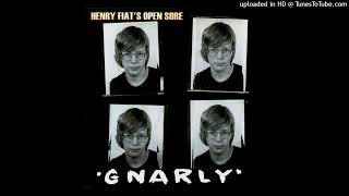 Watch Henry Fiats Open Sore Desto In Ms Fiat video