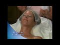 facial