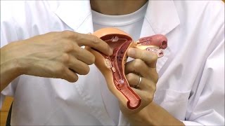 子宮と卵巣の疾患モデル：動画