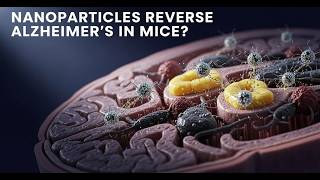 Nanoparticle Breakthrough For Alzheimers