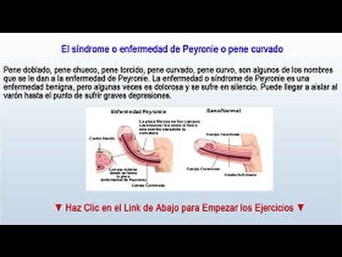 ALARGAMIENTO PENE MANUAL GRATIS alargamiento pene manual gratis: