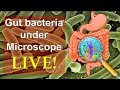 Gut bacteria Escherichia coli under microscope!