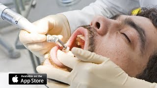 Teeth Cleaning