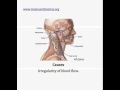 pulsatile tinnitus treatment